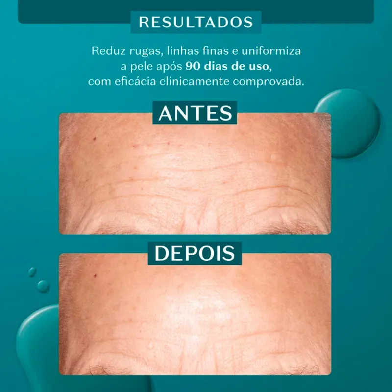 Ácido glicólico renovação4